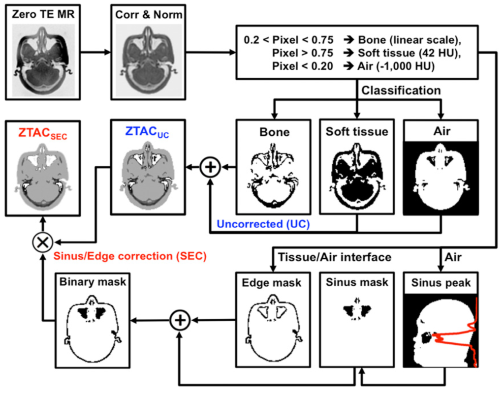 Attenuation Correction | Yang Lab | UT Southwestern, Dallas, Texas