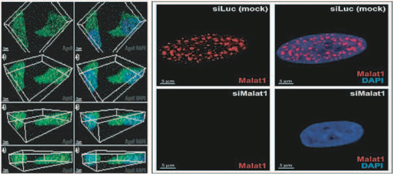 Malati scans