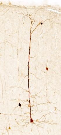 Pyramidal neurons in mouse cerebral cortex transduced with AAV.