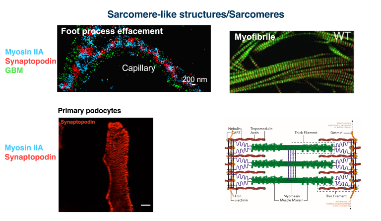Sarcomere-like actin structures in podocytes; fluorescence shows synaptopodin with myosin IIA along capillary.