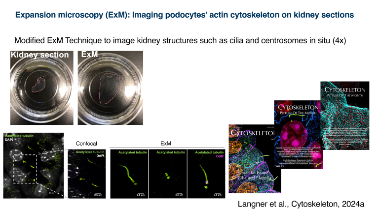 Expansion microscopy of kidney sections: sample expansion reveals podocyte actin, cilia, and centrosomes with enhanced detail over confocal imaging.