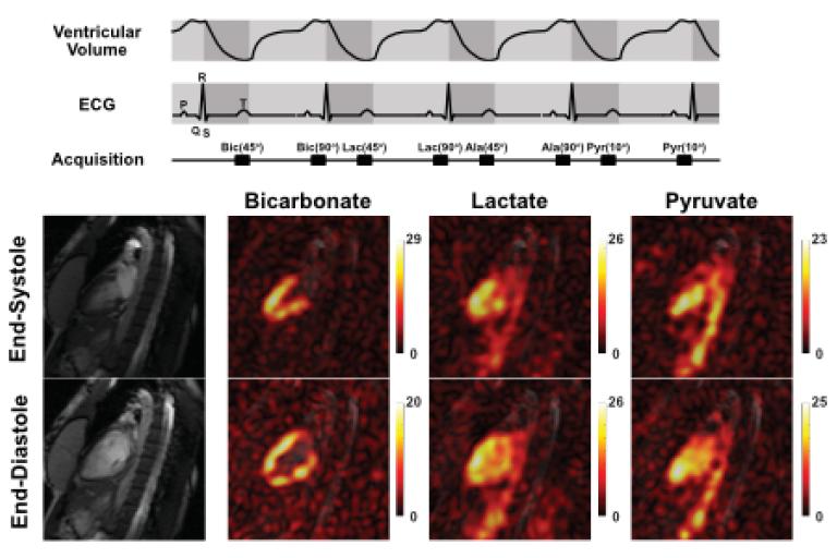 Dual-phase imaging of cardiac metabolism