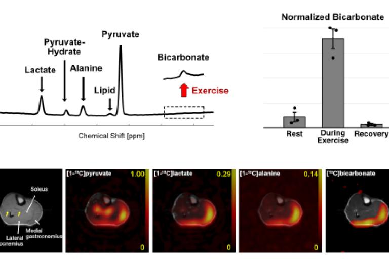 PDH activation in skeletal muscle with exercise