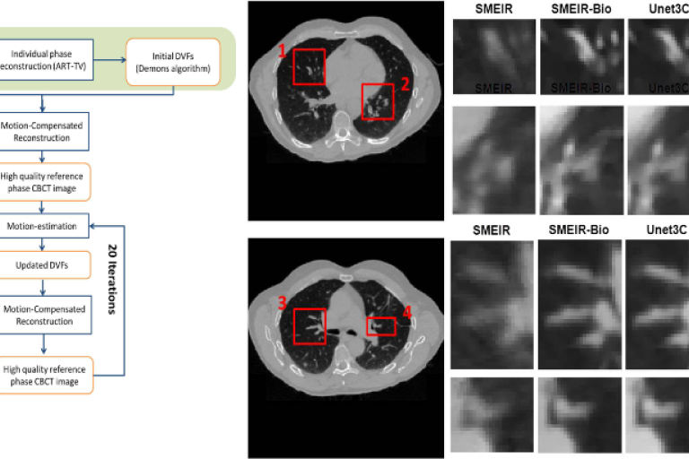 4D-CBCT Reconstruction X-ray comparisons