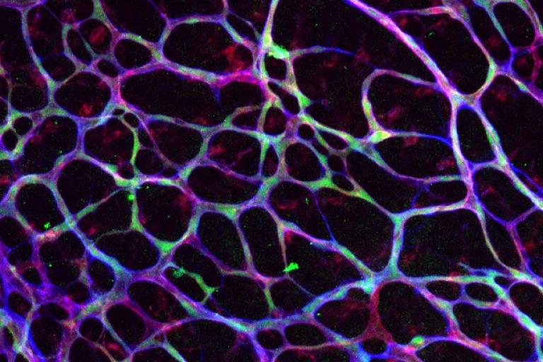 Blood Vessel Formation enlargement