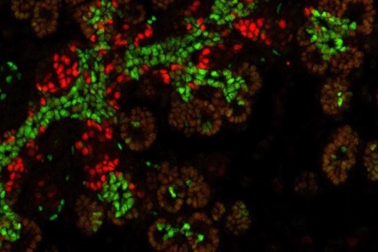 Pancreatic Progenitor Epithelium enlargement