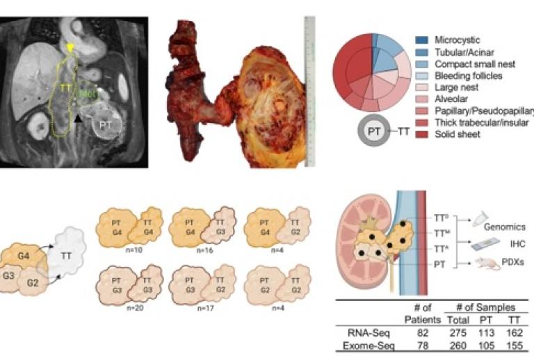ccrcc paper