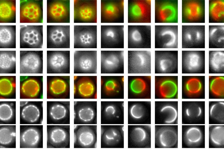 Organelle biogenesis and intracellular lipid trafficking