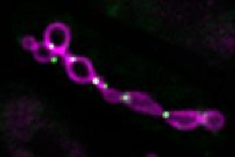 Stalled mitochondrial division without Mdi1