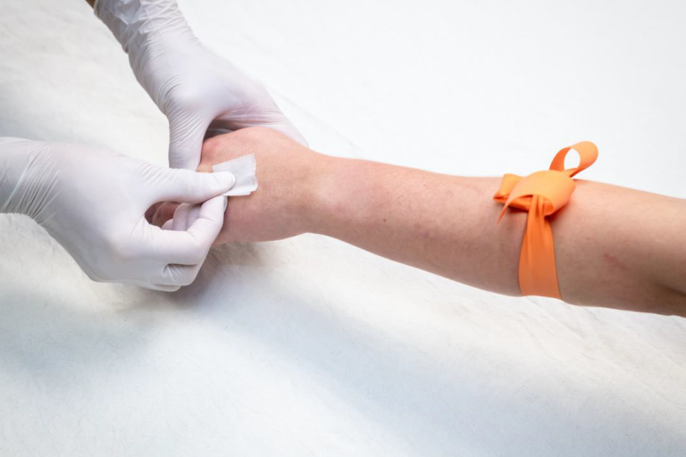 Placeholder imagpatient arm being prepped for an IV