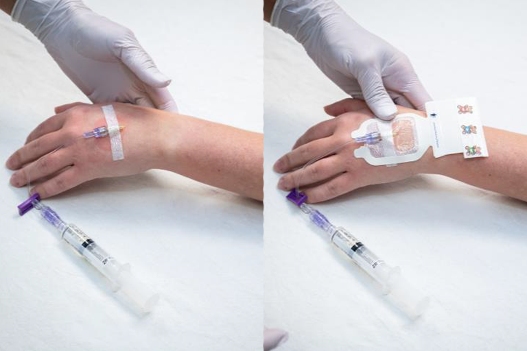 a patient arm being prepped for an IV with needle being secured with tape
