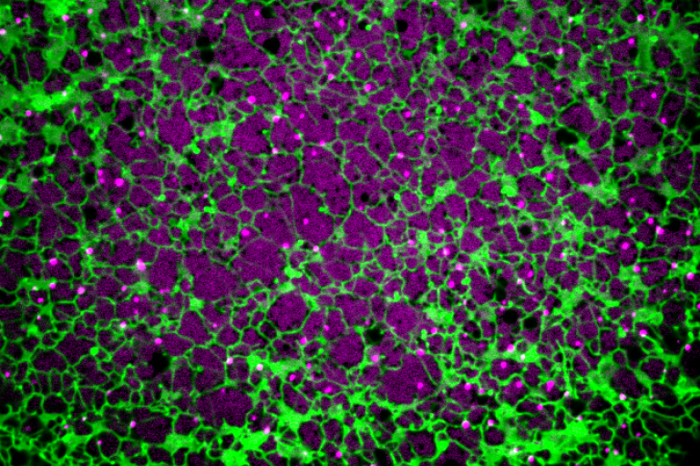 Peroxisomes and the ER imaged in Xenopus egg extract