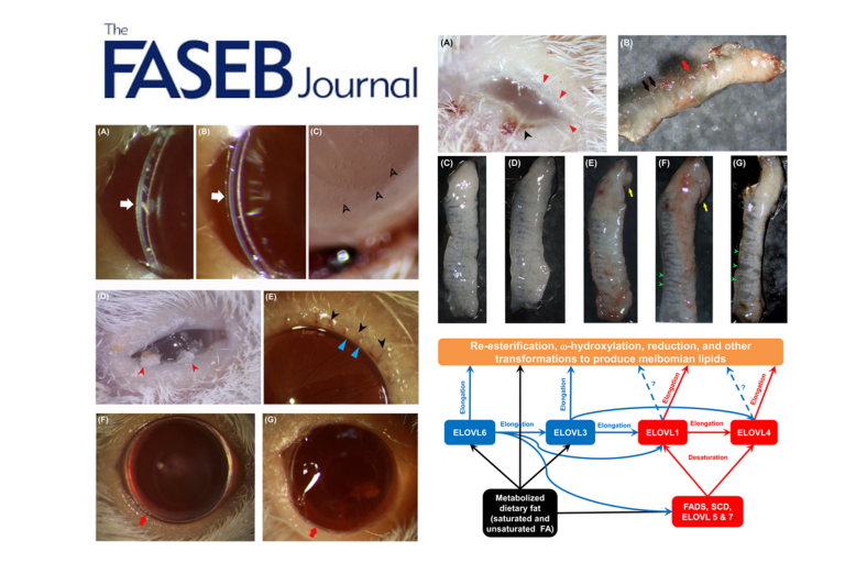 Physiological effects of inactivation and the roles of Elovl3/ELOVL3 in maintaining ocular homeostasis
