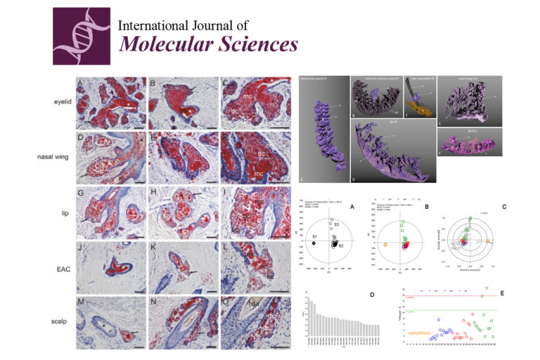 Comparative Characterization of Human Meibomian Glands
