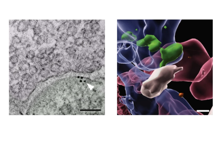 Neuron-glioma synapse