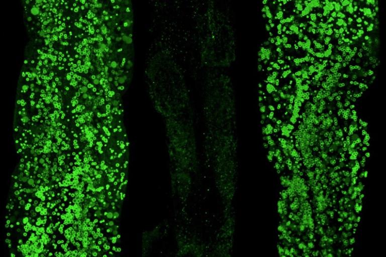 These images show how three Caenorhabditis elegans roundworms use and restore fat (green) during feeding, fasting, and refeeding: full when fed (left), reduced during fasting (middle), and rebuilt after refeeding (right). UT Southwestern researchers found that short fasting cycles can extend lifespan by over 60%, supporting longer, healthier life.