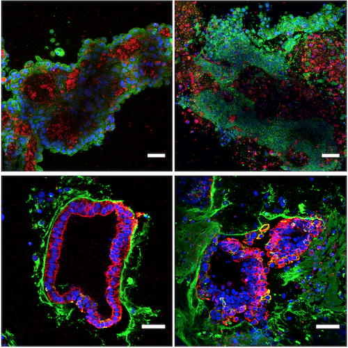 Montage of colonic organoids