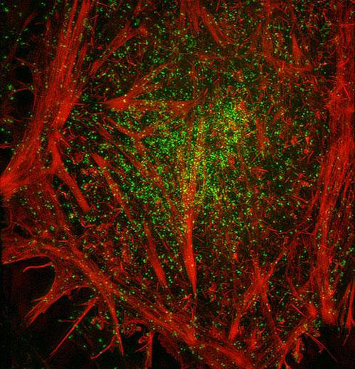 Hela Actin Clathrin