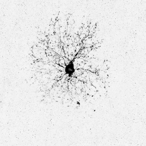 The intermediate stage during oligodendrogenesis
