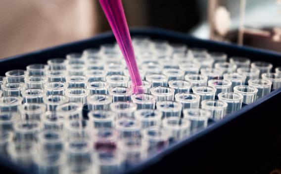 Tray of test tubes with pipet