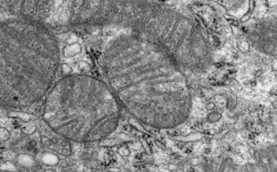 Kidney EM section