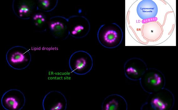 NVJ cells