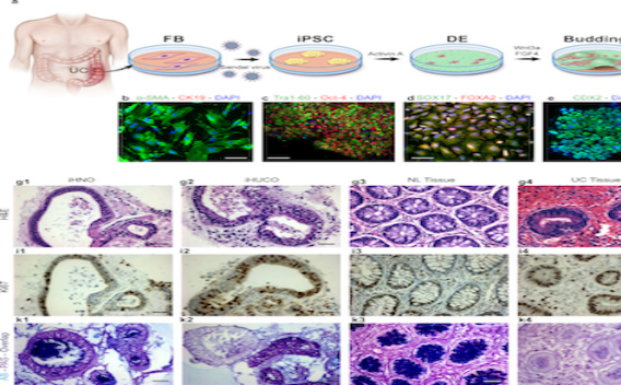 Our latest nature paper, discussing our newest model to study ulcerative colitis pathogenesis.