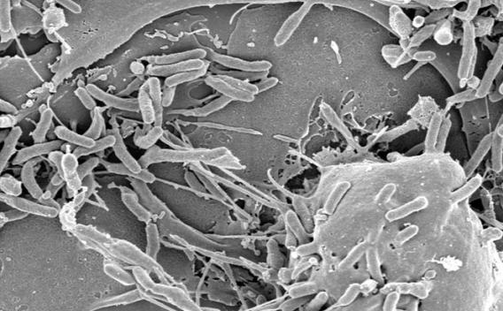 Bacterial pathogens seen through microscope