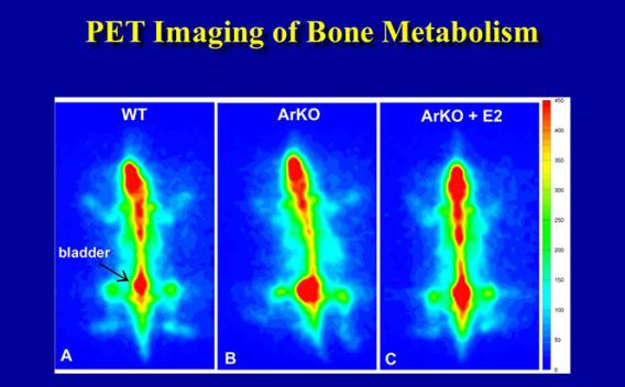 F-18 bone scan on wild-type and aromatase deficient mice (ArKO) without and with estradiol repletion