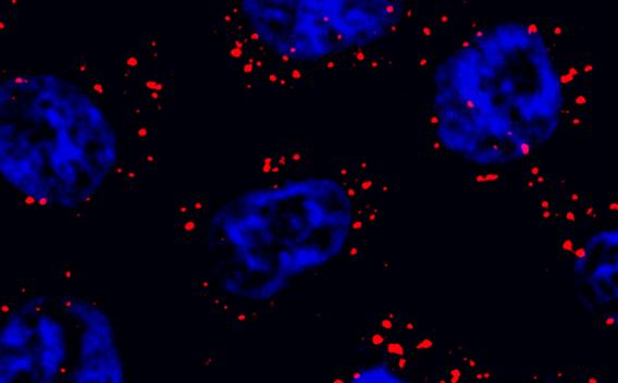 Regulation and function of noncoding RNAs