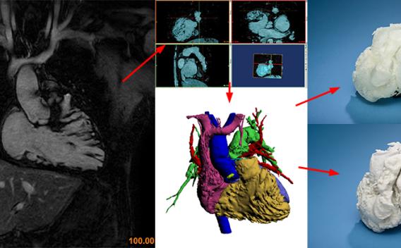 3D Technology in Pediatric Cardiology (3TPC)