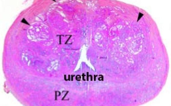 Cross-section of a prostate gland