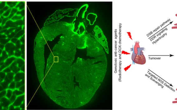 radiotherapy chemotherapy heart