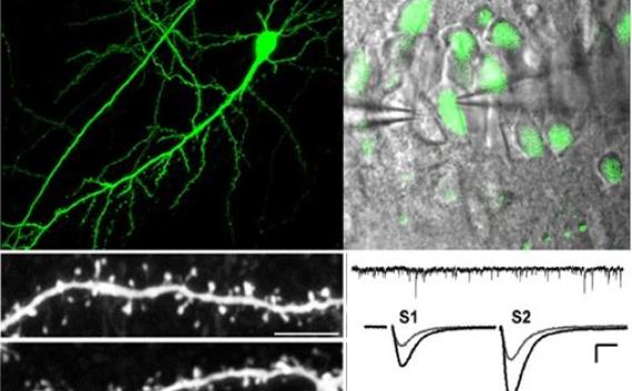 Examples of Huber Lab research