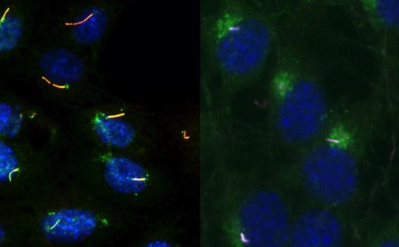 Trafficking into Cilia in PKD