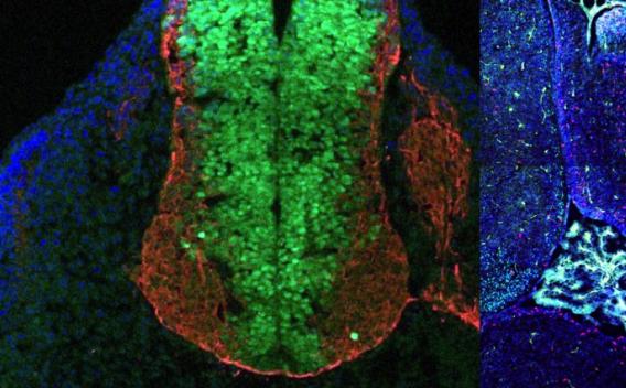 Shh Pathway, Cilia and GPCR Signaling