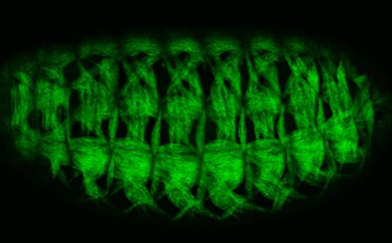 Drosophila myoblast fusion enlargement
