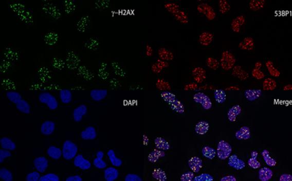 Targeting DNA repair in prostate cancer