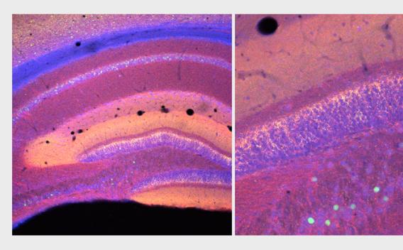 Two microscope slides from Butler Lab