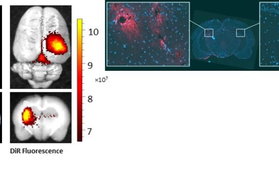 Nanoparticle Delivery to Brain comparison