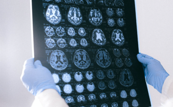 Tech examining x-rays of human brain