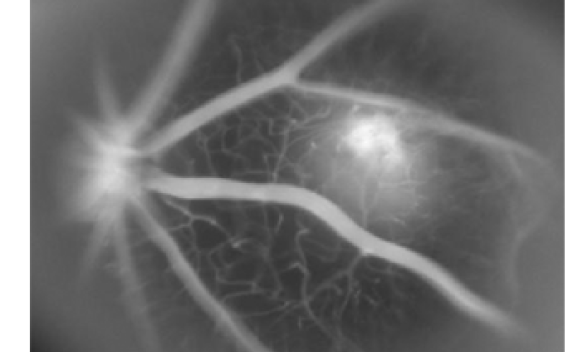 Fluorescein angiogram of laser-induced CNV in a B6 mouse