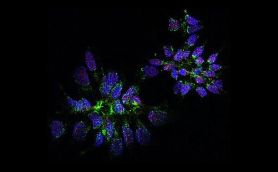 Staining of catalytically active PKA and PKIB by immunofluorescence microscopy in AR-blocked CWR-22Rv1 prostate cancer cells