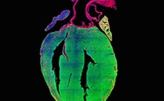 Heart muscle development