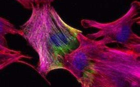 muscle regeneration