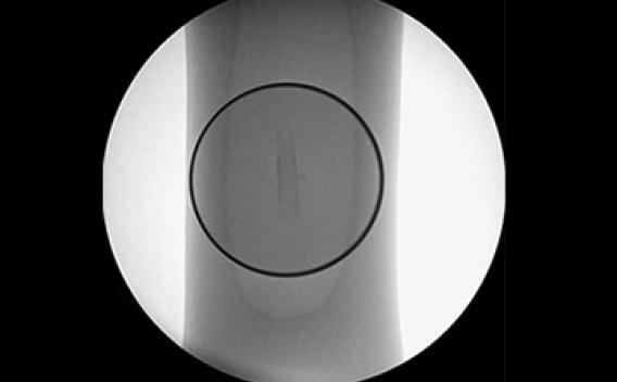 fluoroscopic film