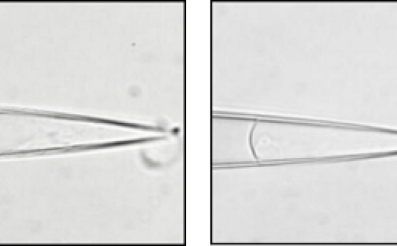 eukaryotic mechanosensitive channels