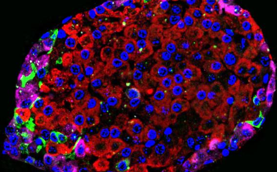 Pancreatic islet