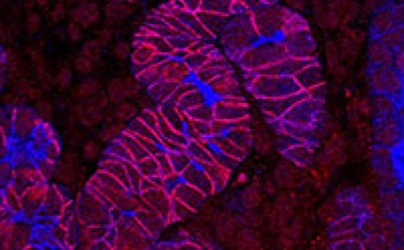 Stained tissue