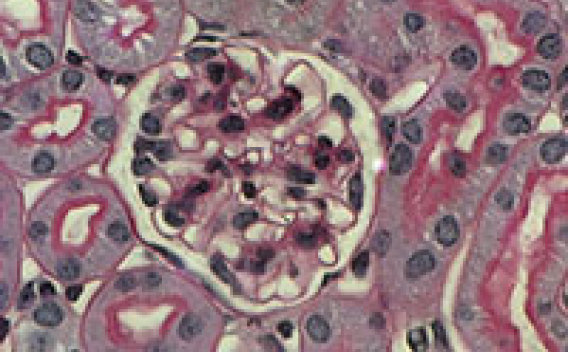 Stained tissue